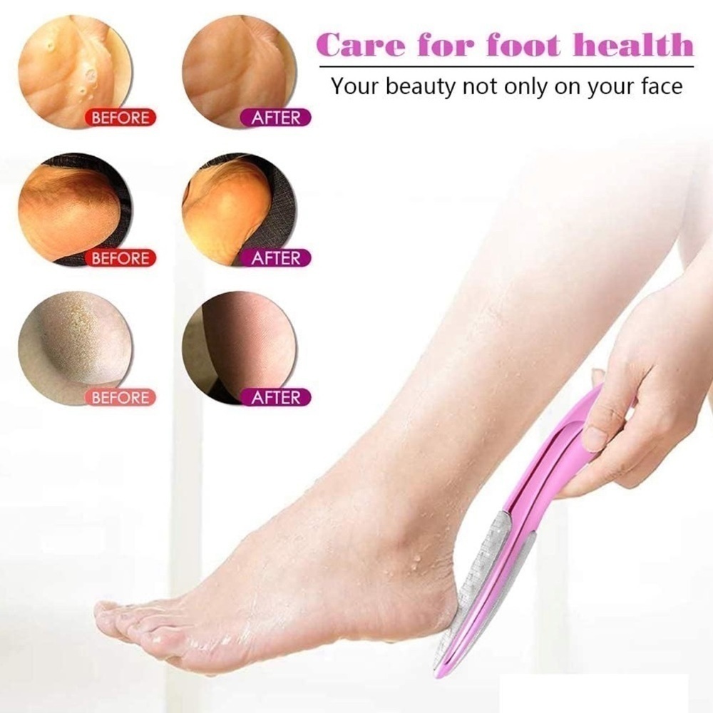 FERYES Foot File Callus Remover - Picture 4 of 11